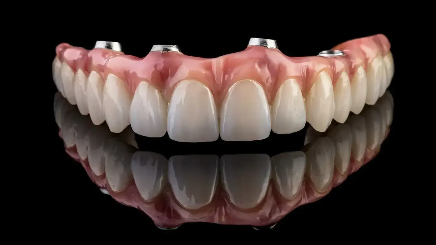 dental lab technician painting final all-on-4 implant bridge