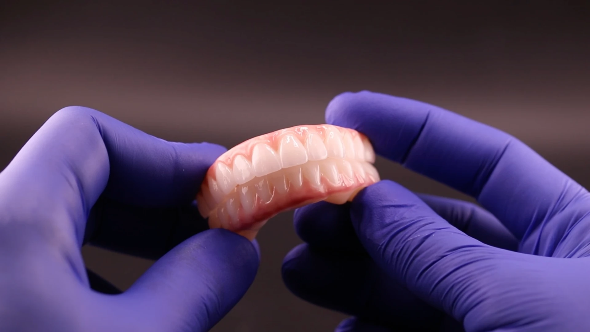 final all-on-4 implant bridges